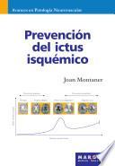 Prevención Del Ictus Isquémico
