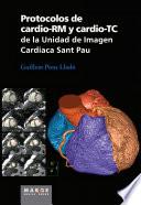 Protocolos De Cardio Rm Y Cardio Tc De La Unidad De Imagen Cardíaca Sant Pau