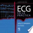 Ecg En La Práctica