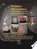 Prótesis Fija Estética